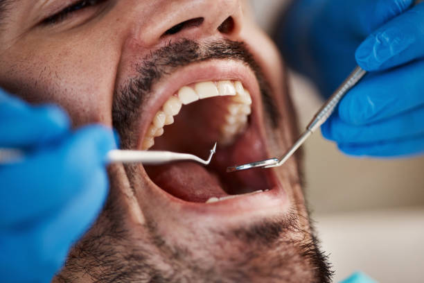 Best Emergency Dental Care for Broken or Chipped Teeth in Sinking Spring, PA